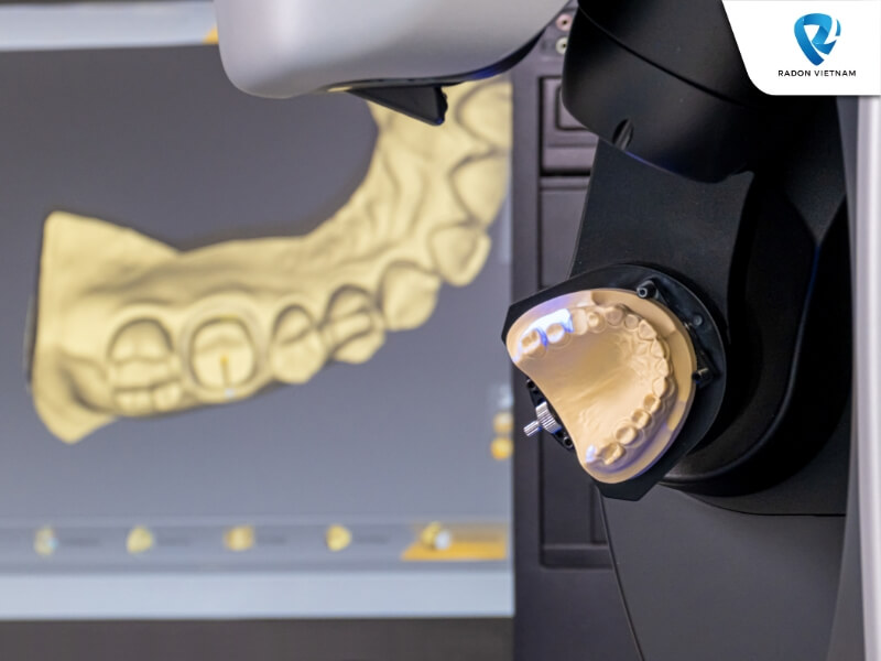 Công nghệ in 3D giúp tạo ra mão răng, cầu răng, implant có độ chính xác, thẩm mỹ cao (Nguồn ảnh: Sưu tầm)