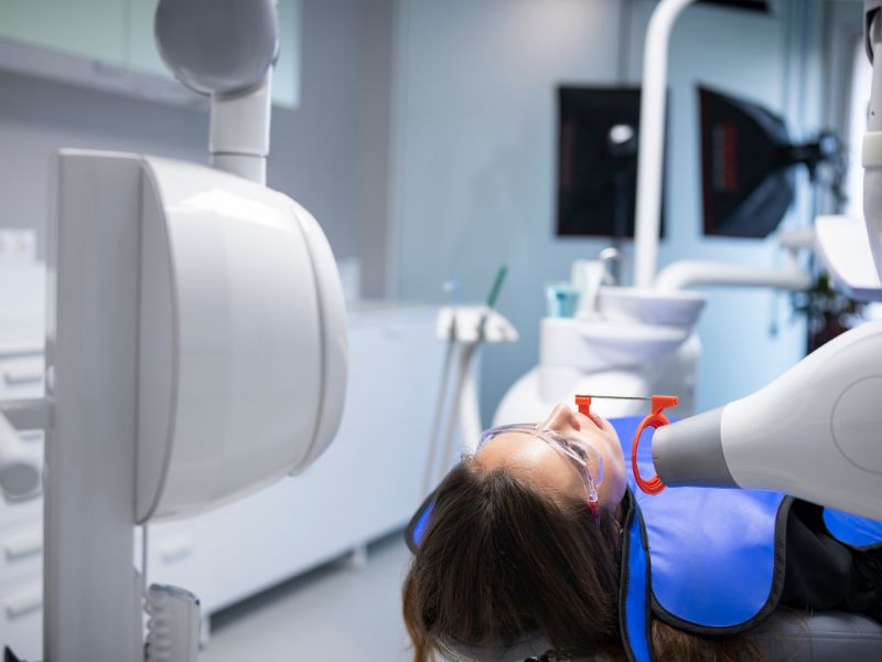 chụp x quang răng