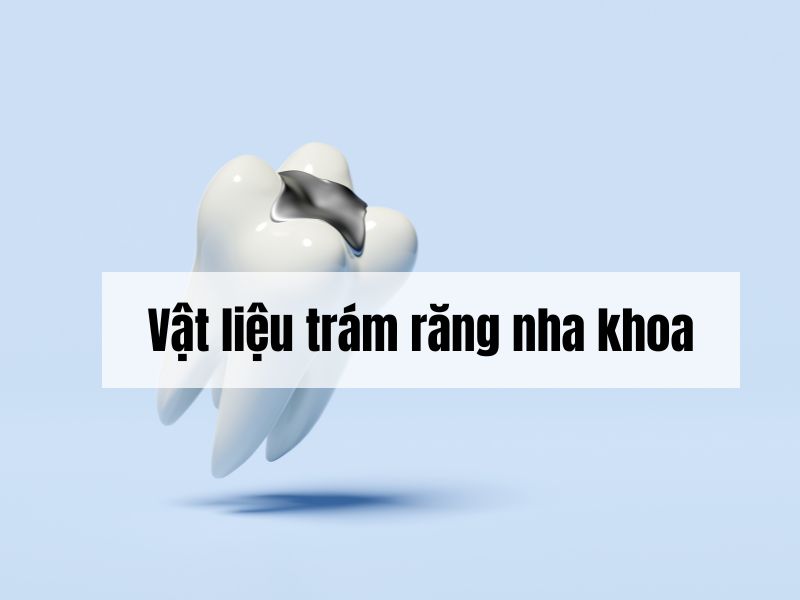 Vật liệu trám răng nha khoa