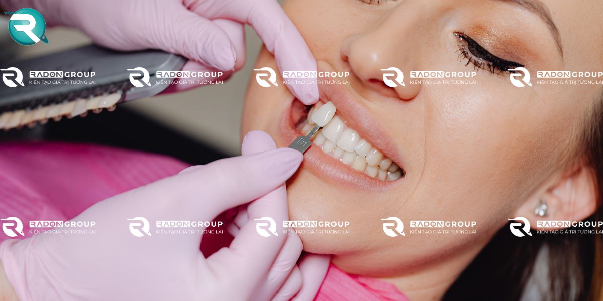 Răng ố vàng, nhiễm màu ở mức độ nhẹ