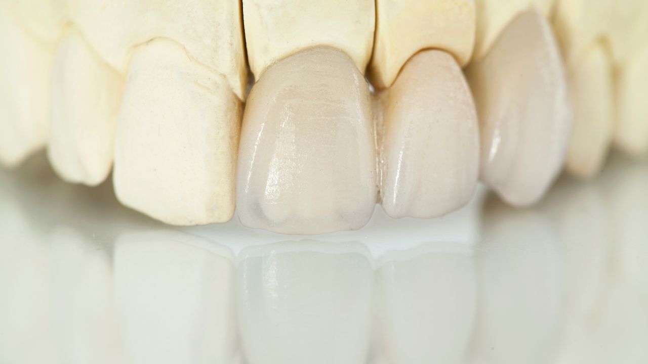 Sử dụng vật liệu sứ giá rẻ, không rõ nguồn gốc