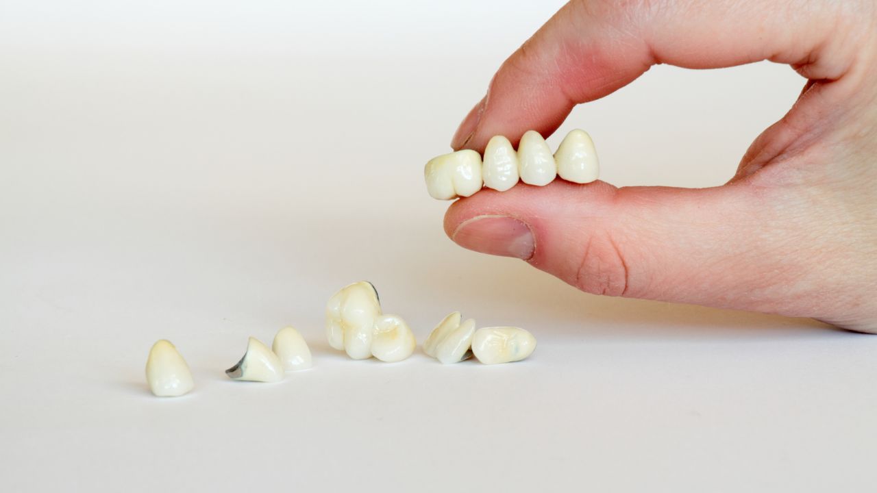 Độ bền cao, bảo vệ răng gốc bên trong