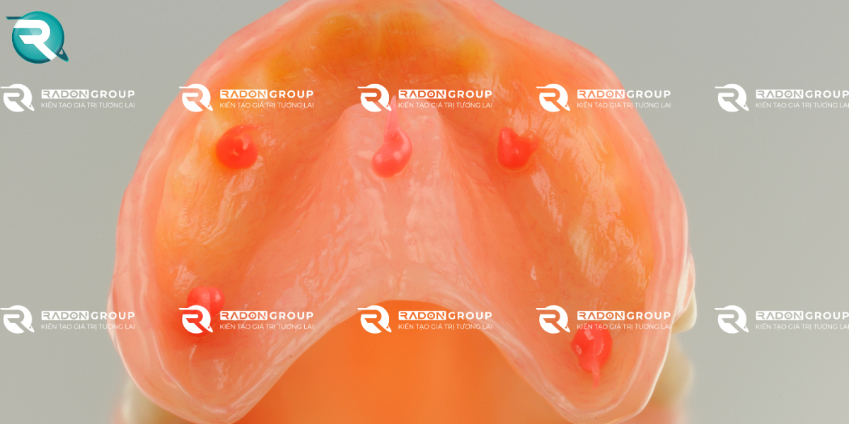 Bôi keo fixodent lên hàm răng giả