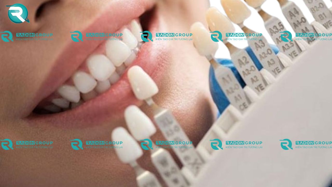 Các mức độ sáng tối trong mỗi nhóm