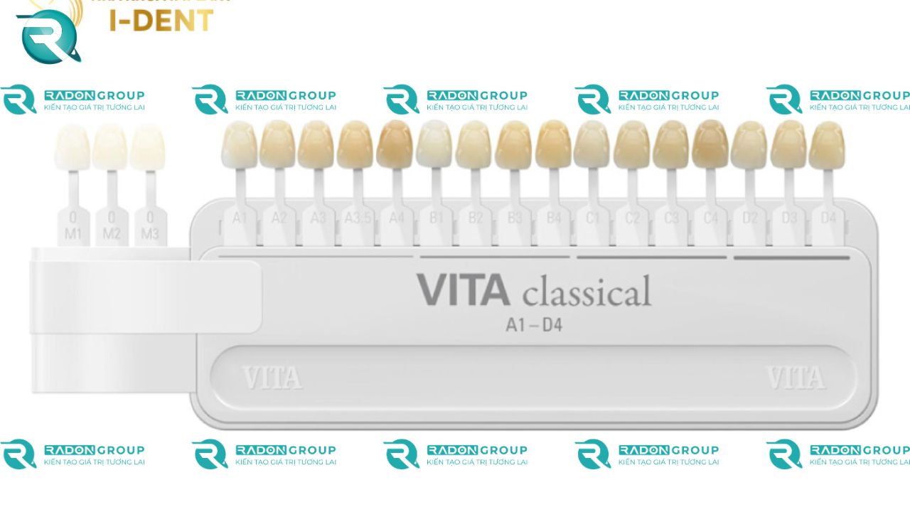 Các tông màu của răng theo bảng màu như Vita Classical