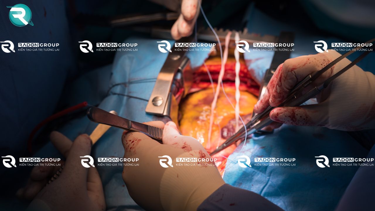 Chỉ khâu Trong phẫu thuật nội tạng