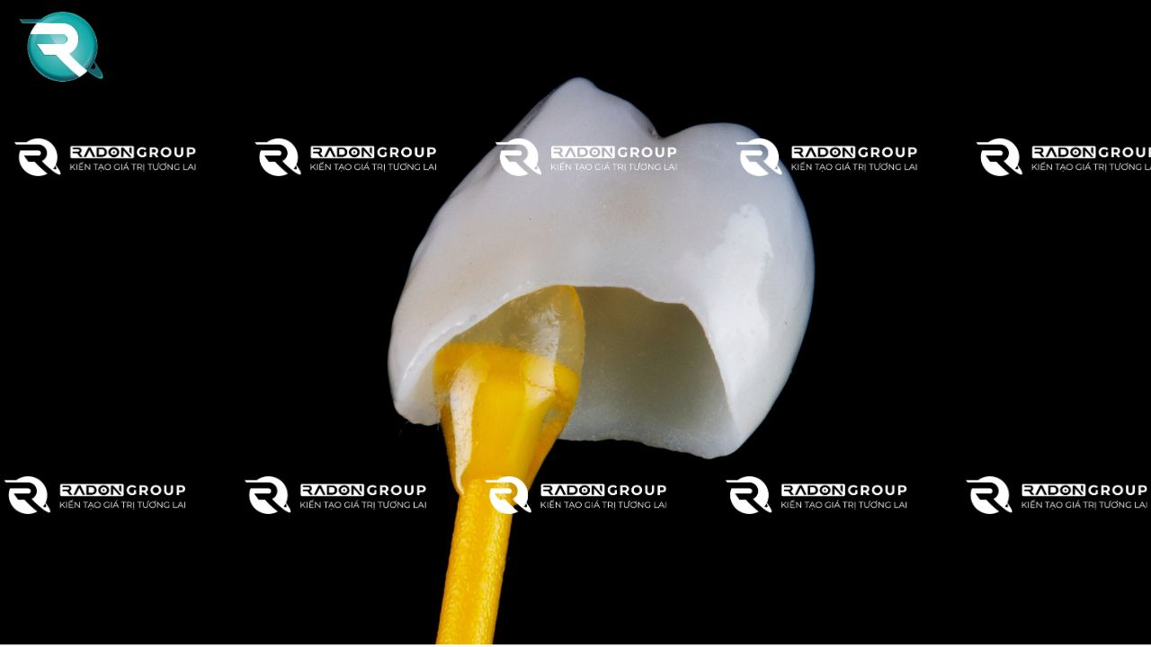 Dán mão răng, cầu răng và răng giả tạm thời