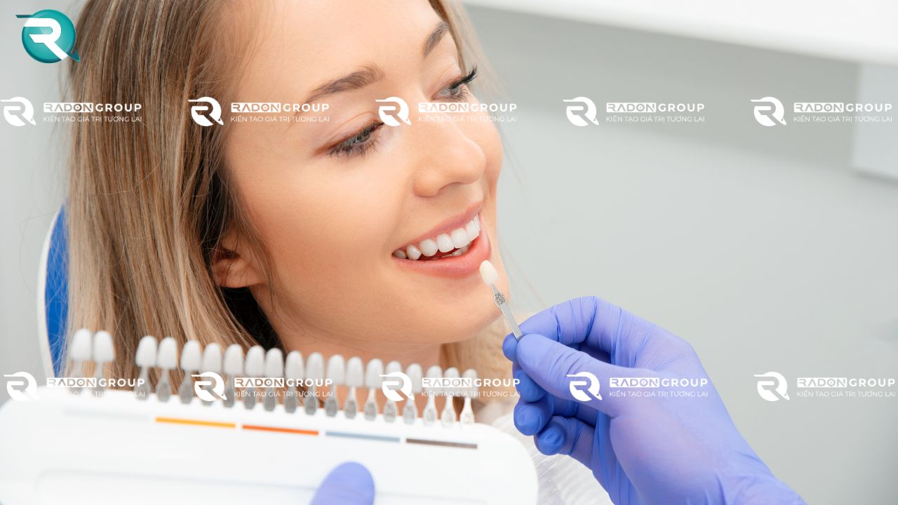 Đối tượng lý tưởng nên làm veneers