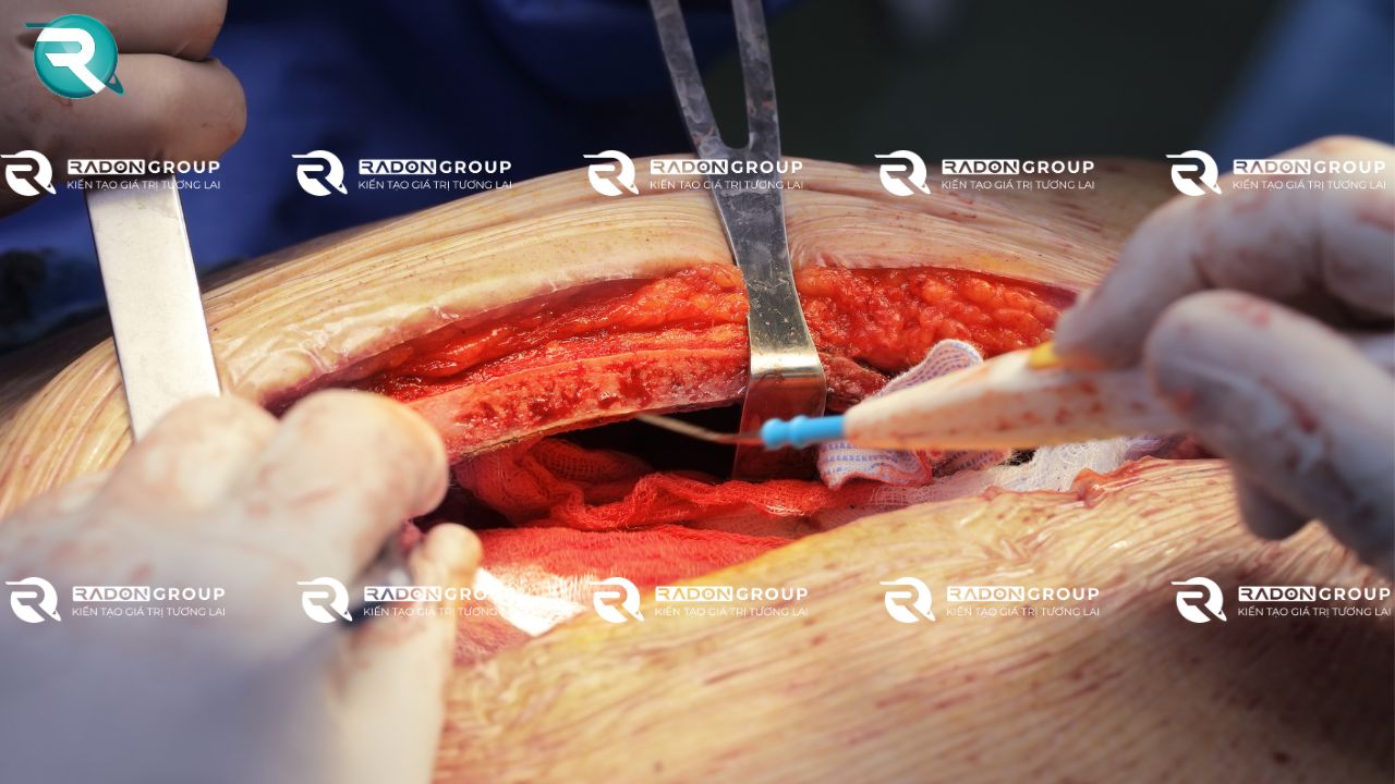 Phẫu thuật tim mạch và lồng ngực