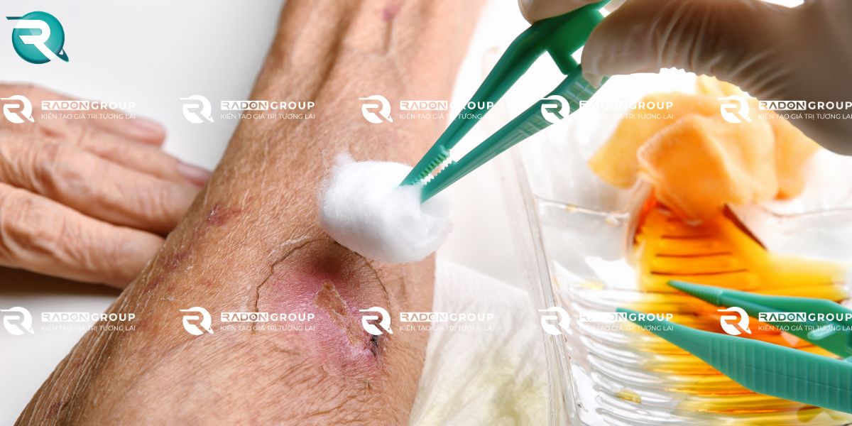 Sát khuẩn vết thương, trầy xước