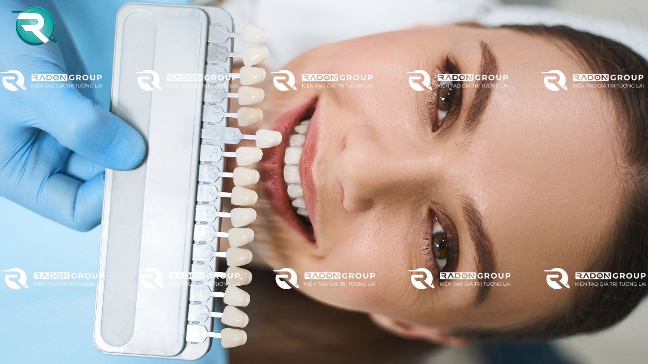 Sự khác biệt giữa veneers và bọc răng sứ