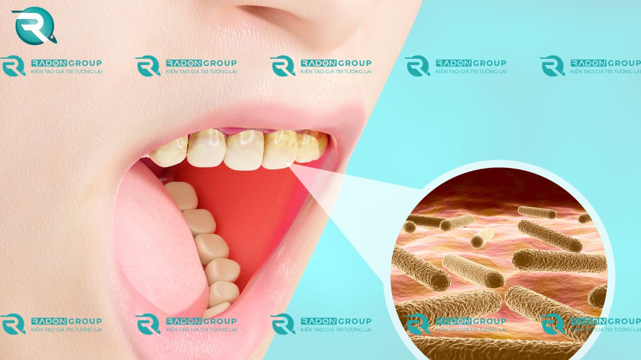 Tác động diệt khuẩn_ Phân ly ion hydroxyl (OH-)