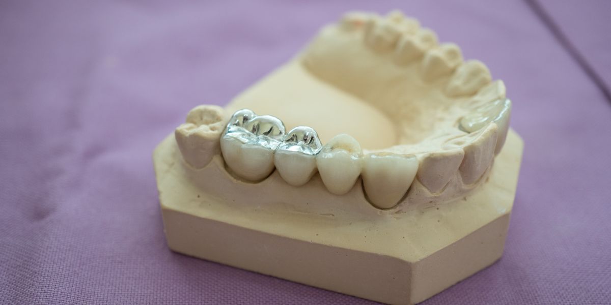 Thành phần chính