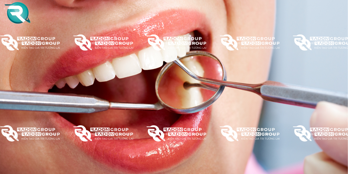 Tính thẩm mỹ cao, màu sắc như răng thật