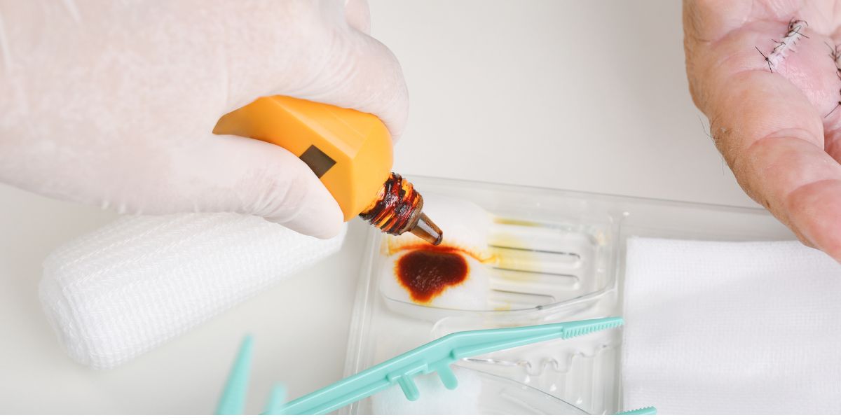 Ứng dụng khử trùng khác