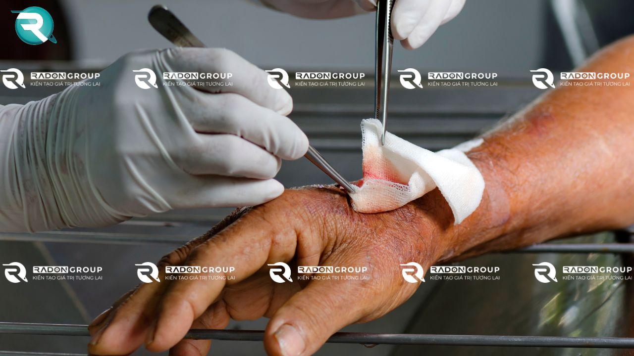 Vệ sinh và bảo vệ vết thương đúng cách