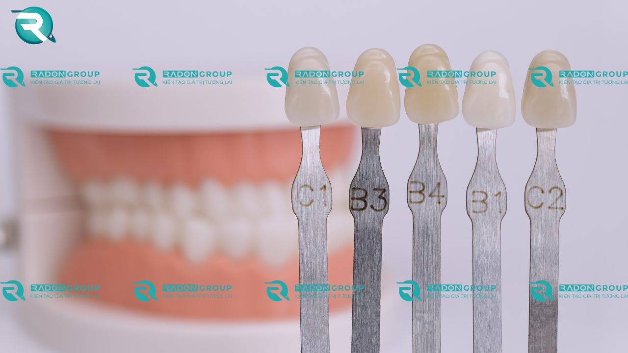 các tông màu của răng