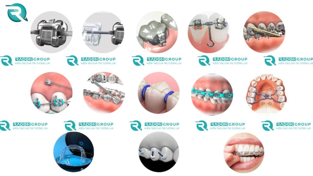 khí cụ chỉnh nha